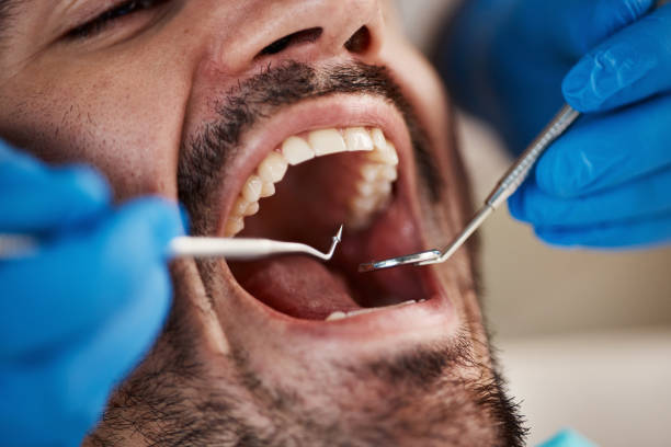 Best Pediatric Emergency Dentist in Saranap, CA